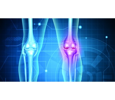 Osteoarthritis